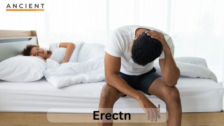 A Guide to Erectn